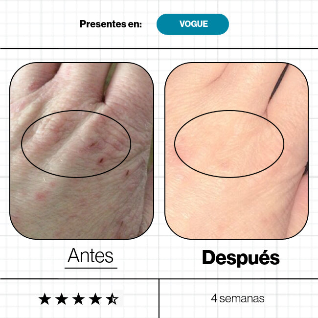 Skin Omegas